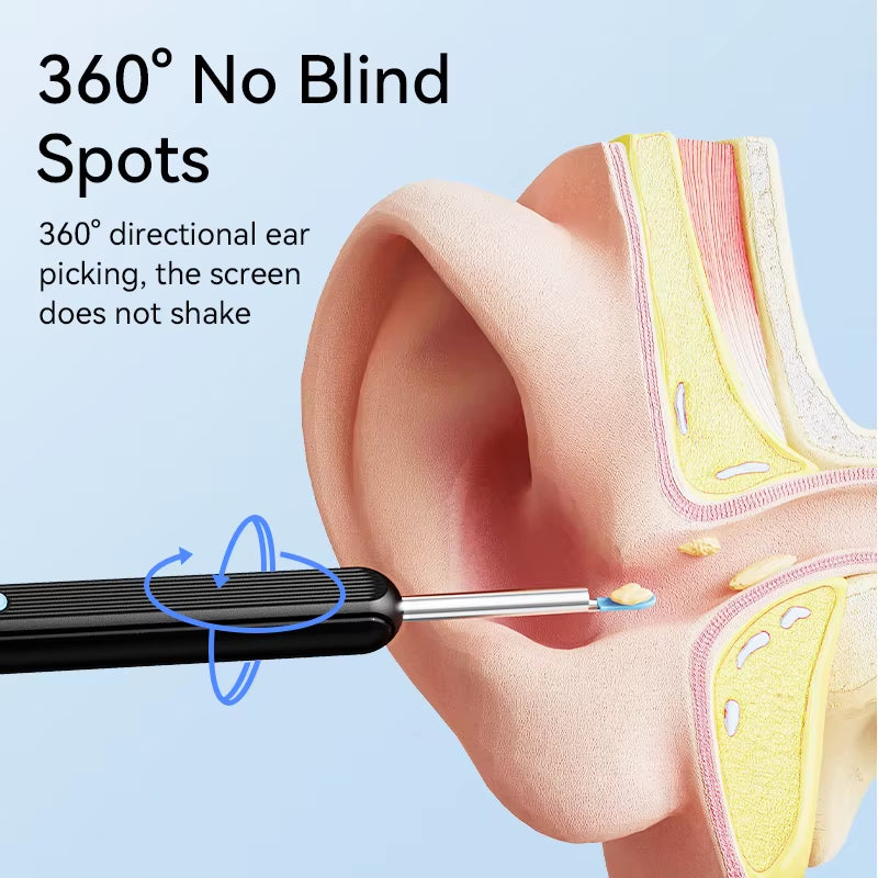 Ear Cleaner High Precision Ear Wax Removal Tool with Camera with LED Light Wireless Cleaner Smart Ear Cleaning Kit Health Care